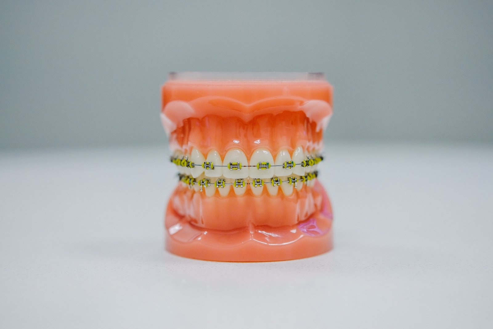 Image illustrant l'orthodontie.